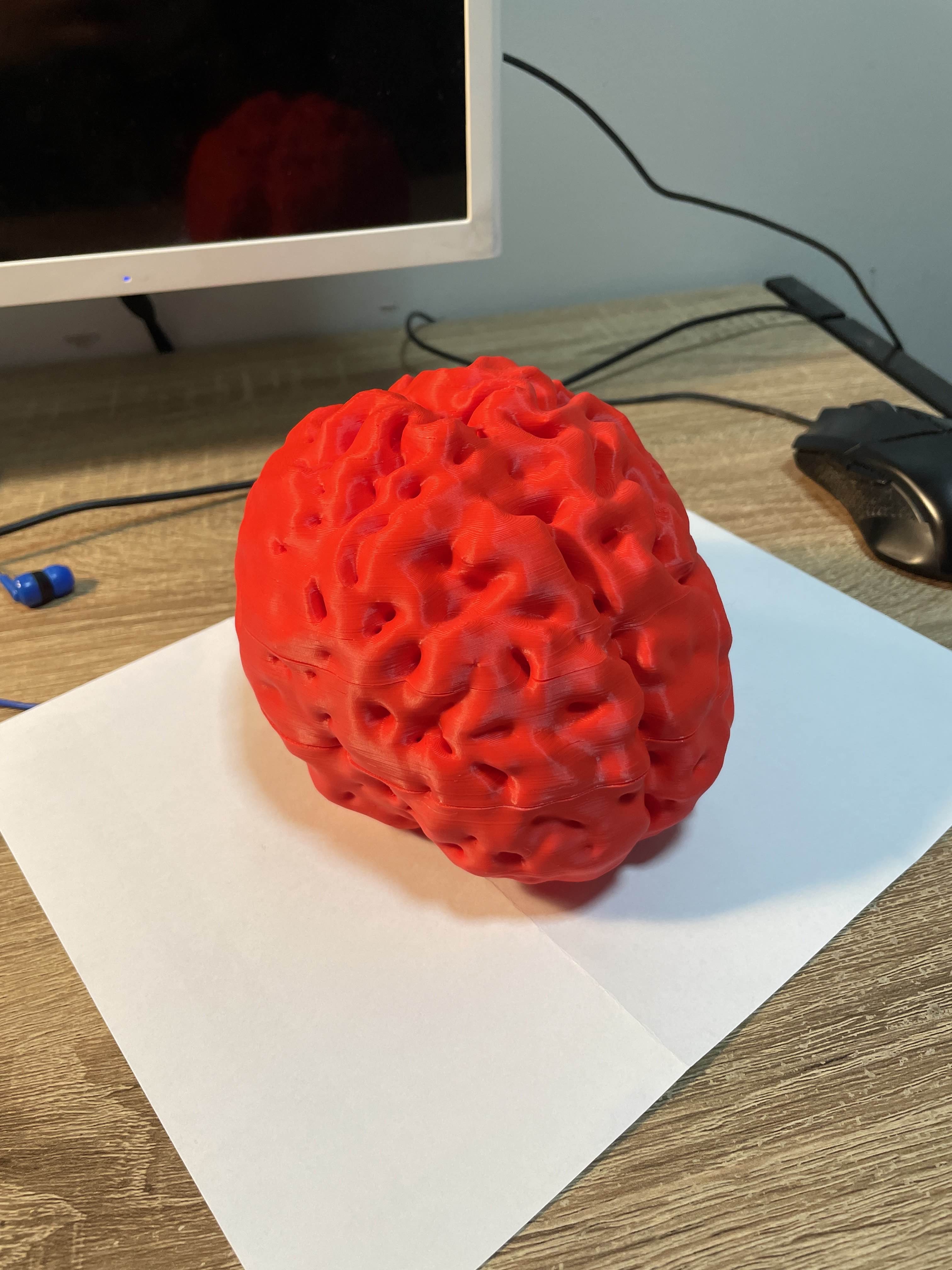 3D Printing an MRI Brain Scan image